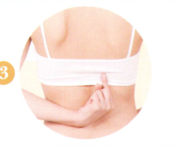 三叉神经痛拔罐