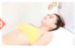 面神经麻痹拔罐