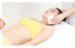 面神经麻痹拔罐