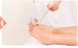 肋间神经痛艾灸