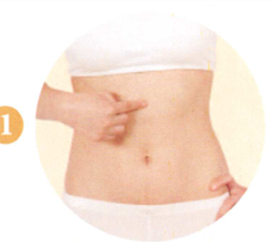 肠易激综合征艾灸