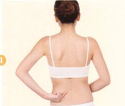 腰椎间盘突出拔罐