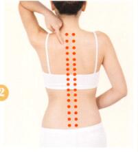 强直性脊柱炎拔罐