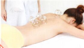 风湿性关节炎拔罐