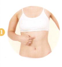 梅尼埃综合征拔罐