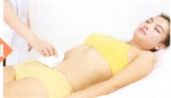 梅尼埃综合征拔罐