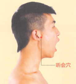 耳鸣-耳聋艾灸