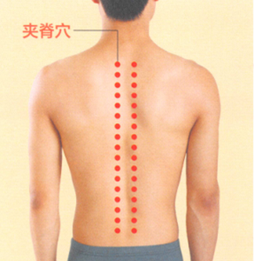 强直性脊柱炎艾灸