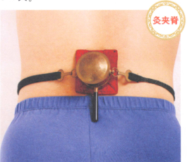 强直性脊柱炎艾灸