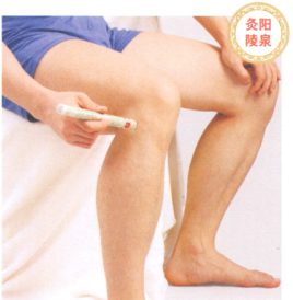 强直性脊柱炎艾灸