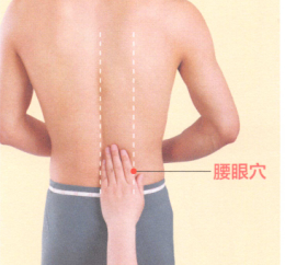 腰间盘突出症艾灸