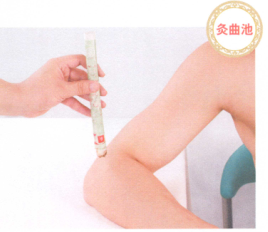 类风湿性关节炎艾灸