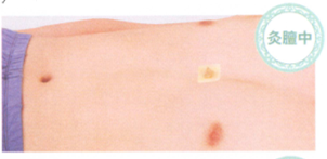 延年益寿艾灸调理方艾灸