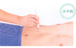 胃十二指肠溃疡艾灸