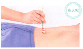 胃十二指肠溃疡艾灸