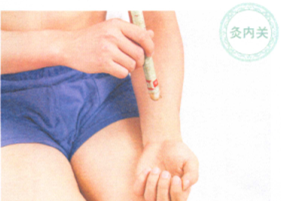 胃十二指肠溃疡艾灸