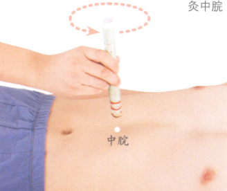 消化性溃疡艾灸