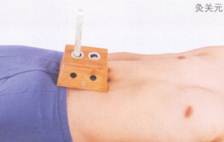 消化性溃疡艾灸