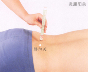 慢性腰肌劳损艾灸