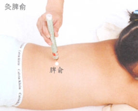 小儿疳积艾灸