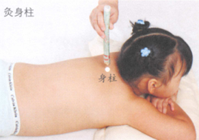 小儿保健艾灸