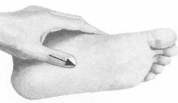 腰椎间盘突出症按摩