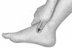 腰椎间盘突出症按摩