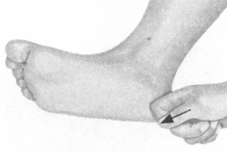 腰椎间盘突出症按摩