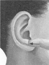 腰椎间盘突出症按摩