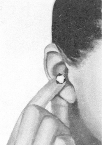 腰椎间盘突出症按摩