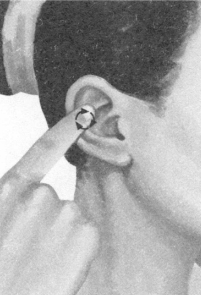 腰椎间盘突出症按摩