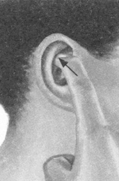 腰椎间盘突出症按摩