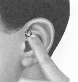 更年期综合征按摩