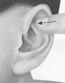 前列腺疾病按摩