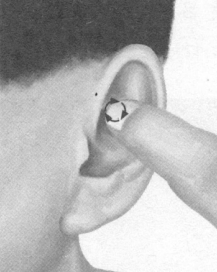 前列腺疾病按摩