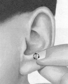 前列腺疾病按摩