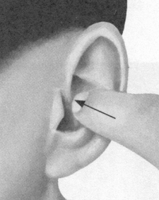 前列腺疾病按摩