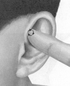 前列腺疾病按摩