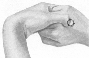 腰椎间盘突出症按摩