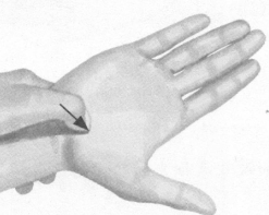 前列腺疾病按摩