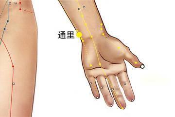 通里穴