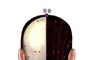 百会穴