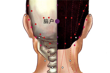 脑户穴